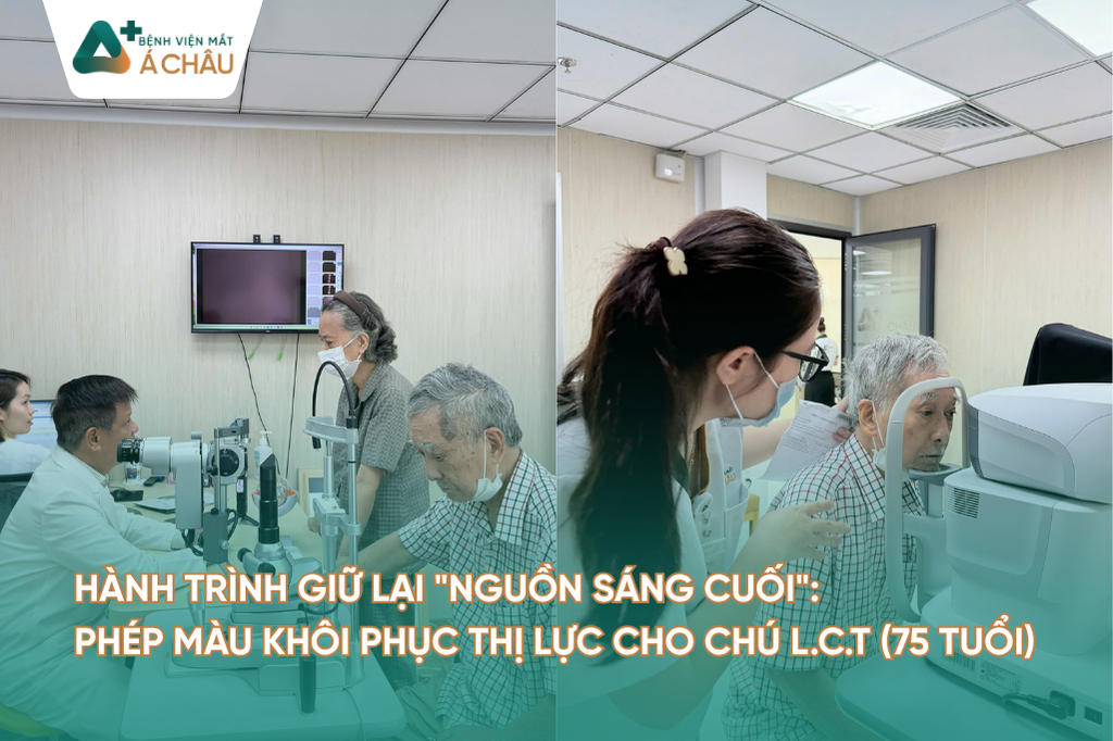 Bé bị cận lệch có dùng được kính đeo ban đêm Ortho K không?